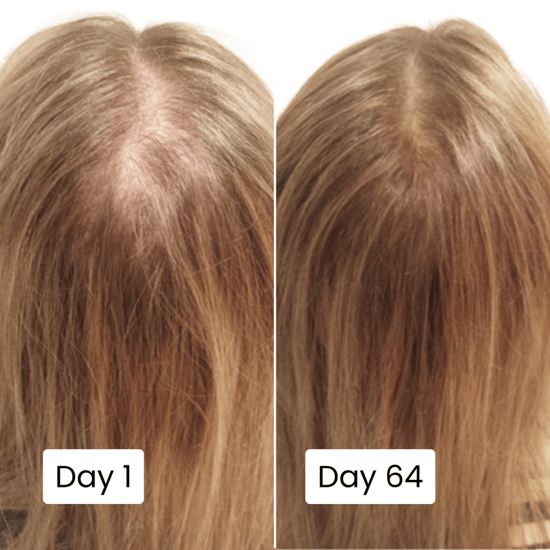 Scalp Hair Growth Serum for Thicker, Healthier Hair
