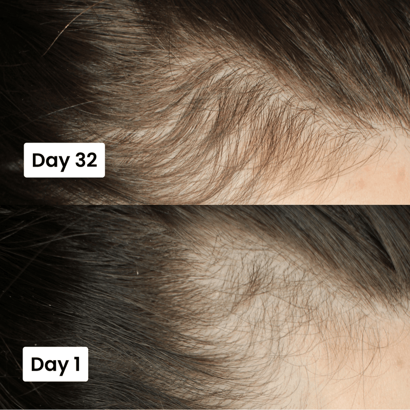 Scalp Hair Growth Serum for Thicker, Healthier Hair